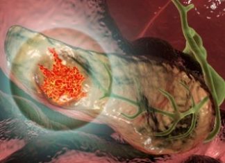Alfa Cytology Launches Full-Scale Preclinical Services for Pancreatic Cancer Research