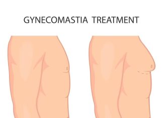 Best Gynecomastia Surgery in Delhi: Achieve Your Desired Result